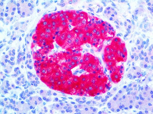 IHC of Chromogranin A on an FFPE Pancreas Tissue